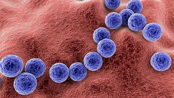 Streptococcus